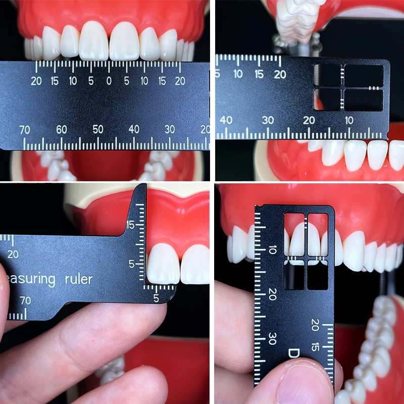 Photography Dental - Autoclaveerbare tandheelkundige precisie-tandenmeetliniaal voor tandheelkundige fotografie,