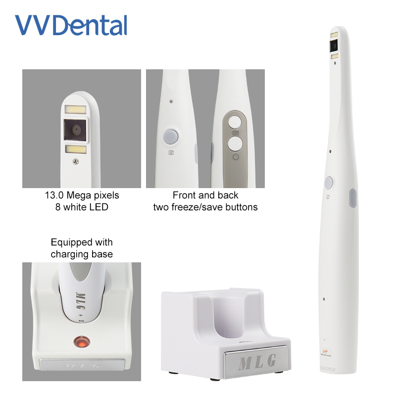 Draadloze intraorale tandheelk - Photography Dental recensie en prijs