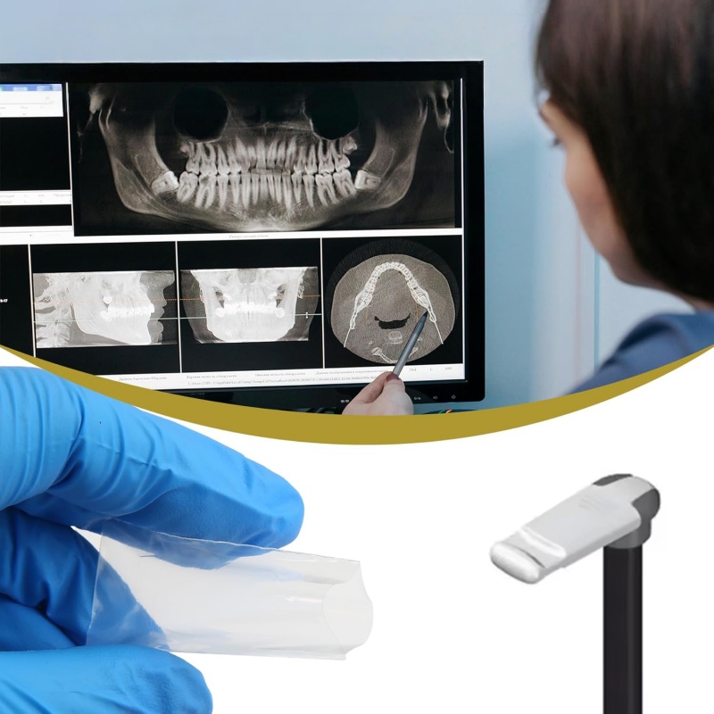 200 stuks/doos Tandheelkundige - Photography Dental recensie en prijs